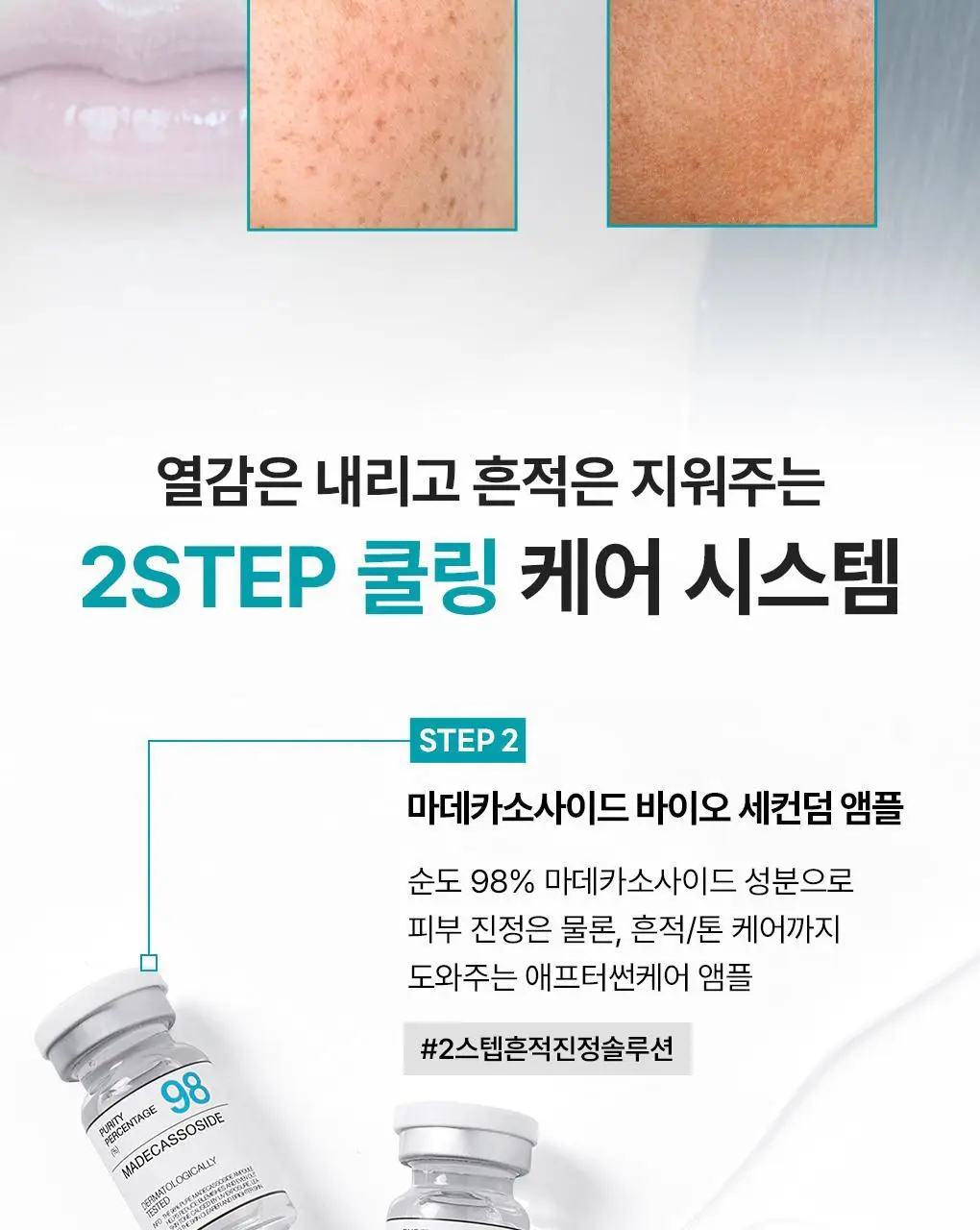 [피지흡착/10매] 메디힐 바이오 세컨덤 마스크 3종 (마데카소사이드, PDRN, 히알루론산) 상세페이지 2